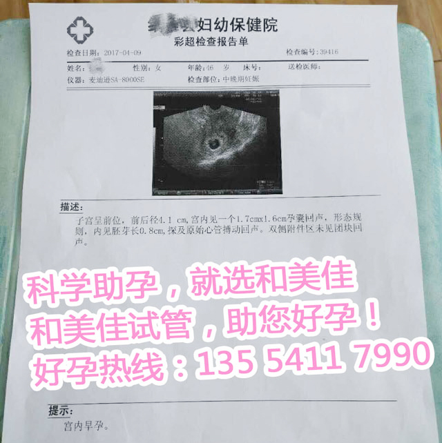 基因检测囊胚移植让孔女士成功妊娠